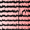 EEG with color coding of dipole strength.