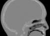 Slice of a pCT image of a human head