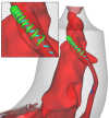 Flow in turbine draft tube